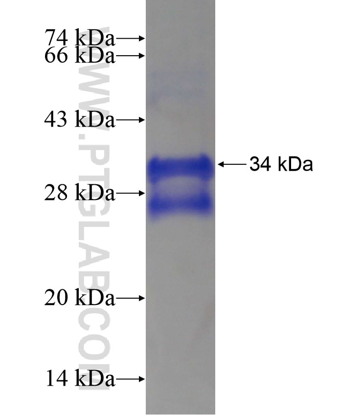 ATP2A1 fusion protein Ag17944 SDS-PAGE