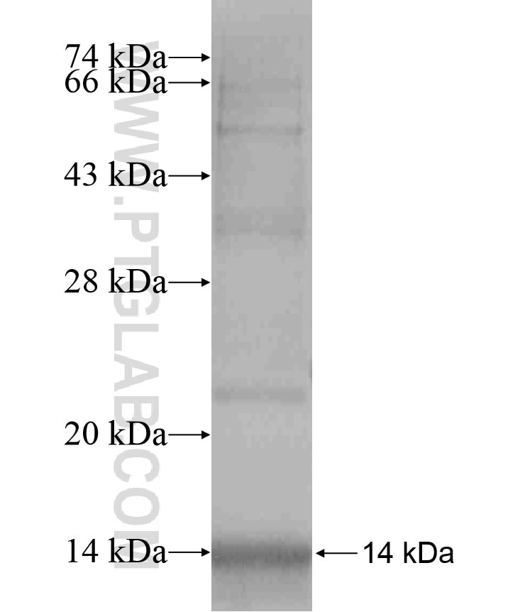 ATP2A1 fusion protein Ag18184 SDS-PAGE