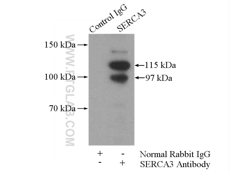 Immunoprecipitation (IP) experiment of mouse skeletal muscle tissue using SERCA3 Polyclonal antibody (13619-1-AP)
