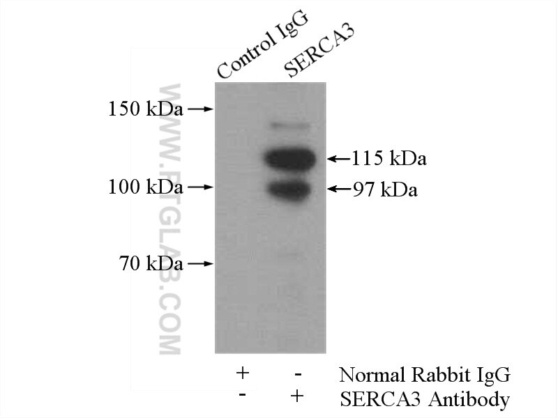 IP experiment of mouse skeletal muscle using 13619-1-AP