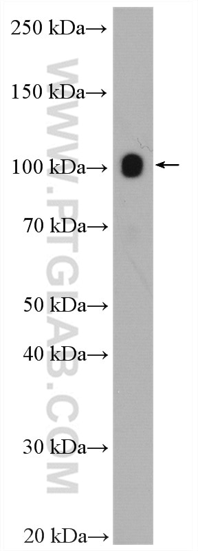 Western Blot (WB) analysis of K-562 cells using SERCA3 Polyclonal antibody (13619-1-AP)