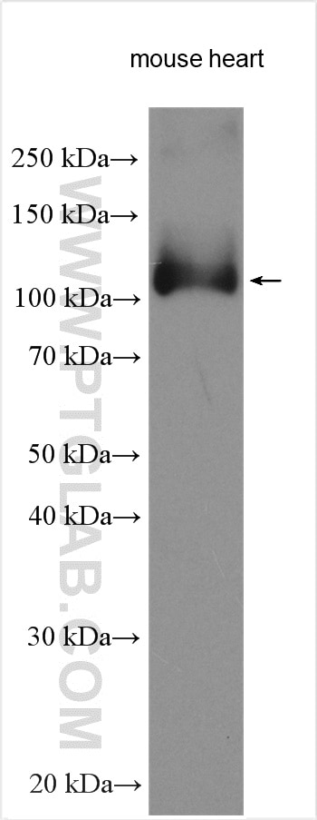 Western Blot (WB) analysis of various lysates using SERCA3 Polyclonal antibody (13619-1-AP)