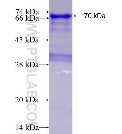 ATP2A3 fusion protein Ag4527 SDS-PAGE