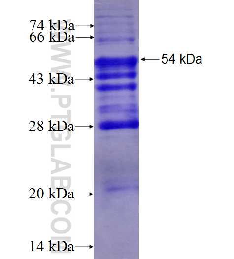 ATP2A3 fusion protein Ag4706 SDS-PAGE