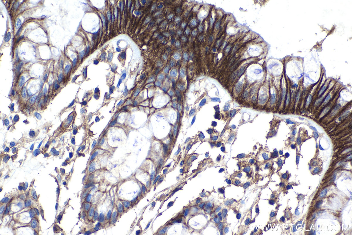 IHC staining of human colon using 30035-1-AP