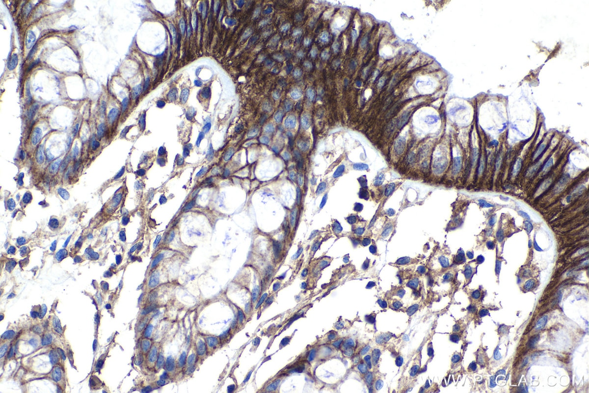 Immunohistochemistry (IHC) staining of human colon tissue using ATP2B1 Polyclonal antibody (30035-1-AP)