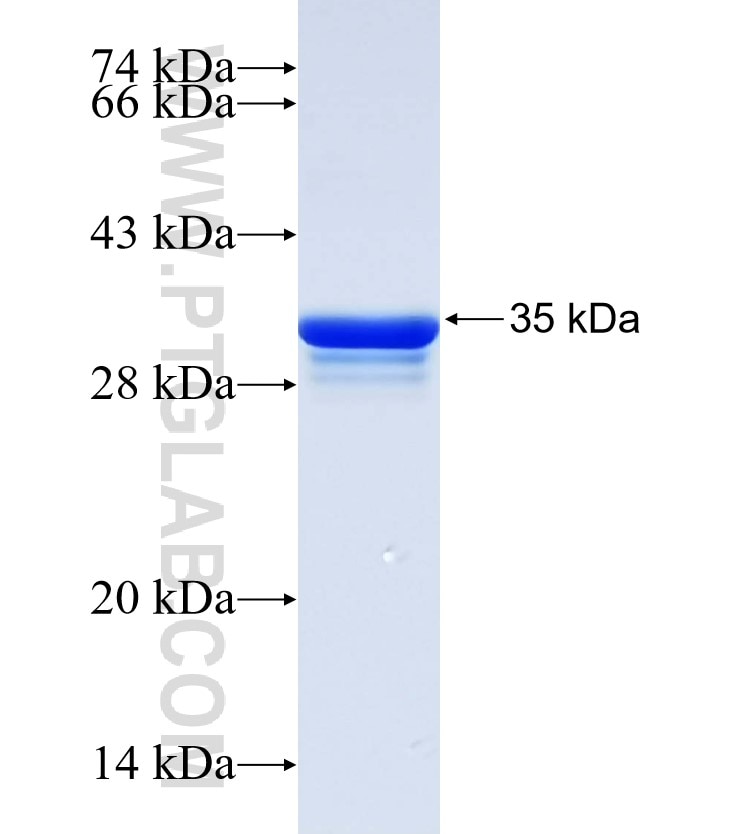 ATP2B1 fusion protein Ag32423 SDS-PAGE