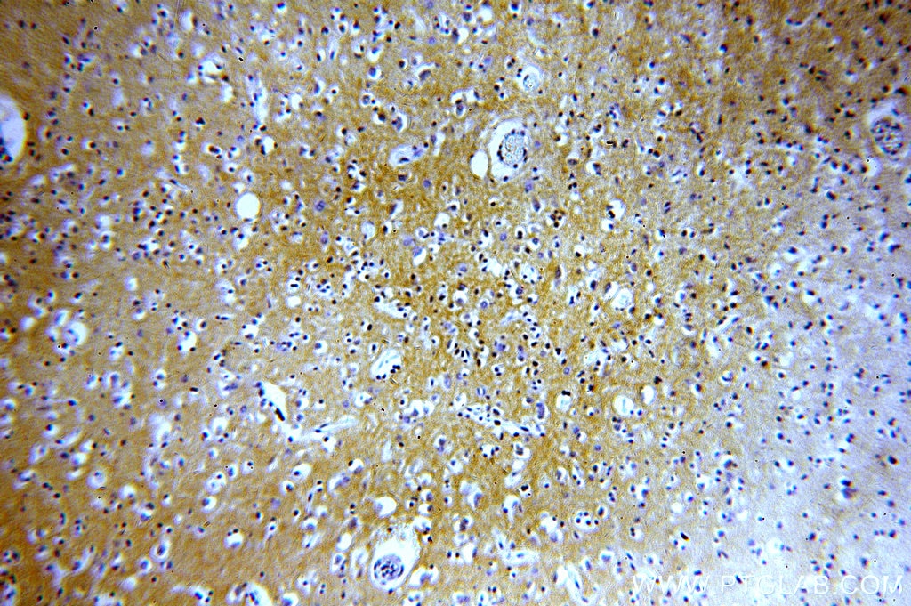 Immunohistochemistry (IHC) staining of human brain tissue using PMCA2 Polyclonal antibody (19678-1-AP)