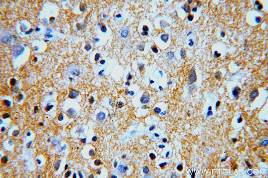Immunohistochemistry (IHC) staining of human brain tissue using PMCA2 Polyclonal antibody (19678-1-AP)