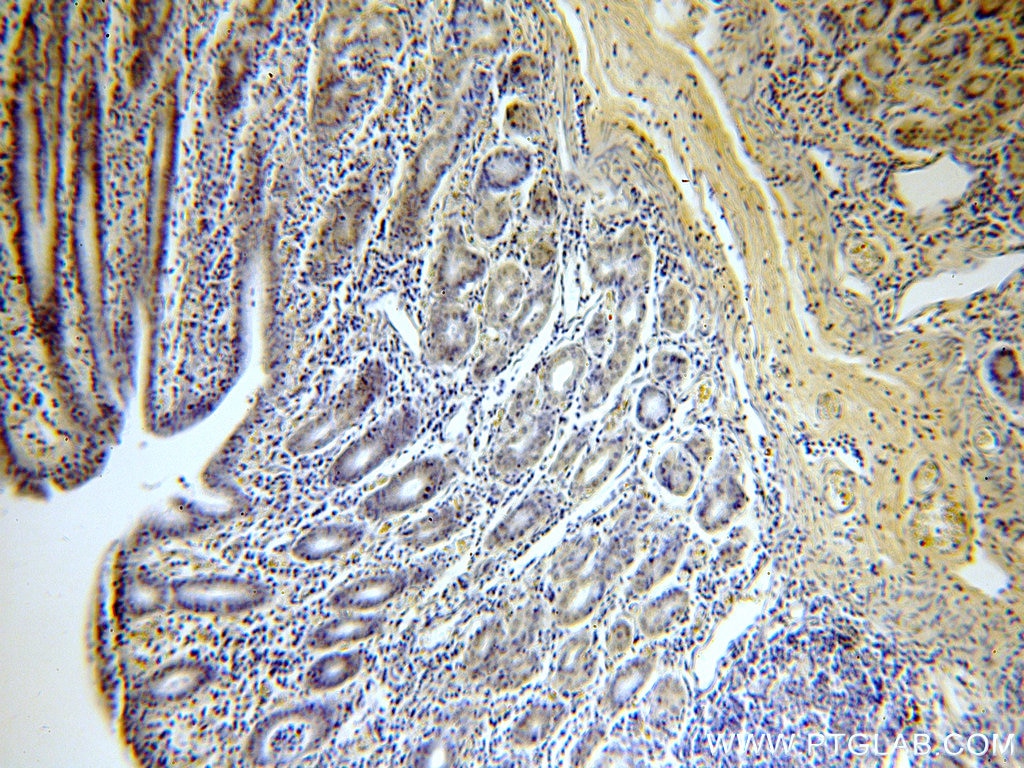 PMCA2