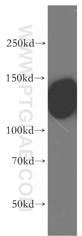 Western Blot (WB) analysis of human brain tissue using PMCA2 Polyclonal antibody (19678-1-AP)