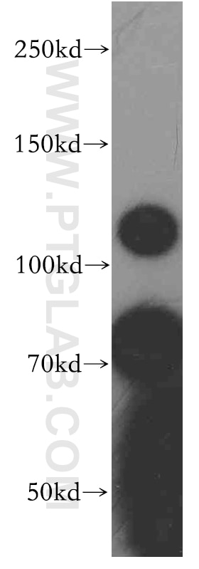 Western Blot (WB) analysis of HEK-293 cells using PMCA2 Polyclonal antibody (19678-1-AP)