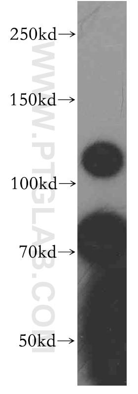 WB analysis of HEK-293 using 19678-1-AP