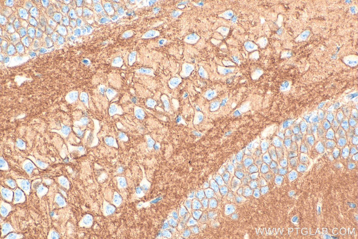 Immunohistochemistry (IHC) staining of mouse brain tissue using ATP2B3/PMCA3 Polyclonal antibody (31692-1-AP)
