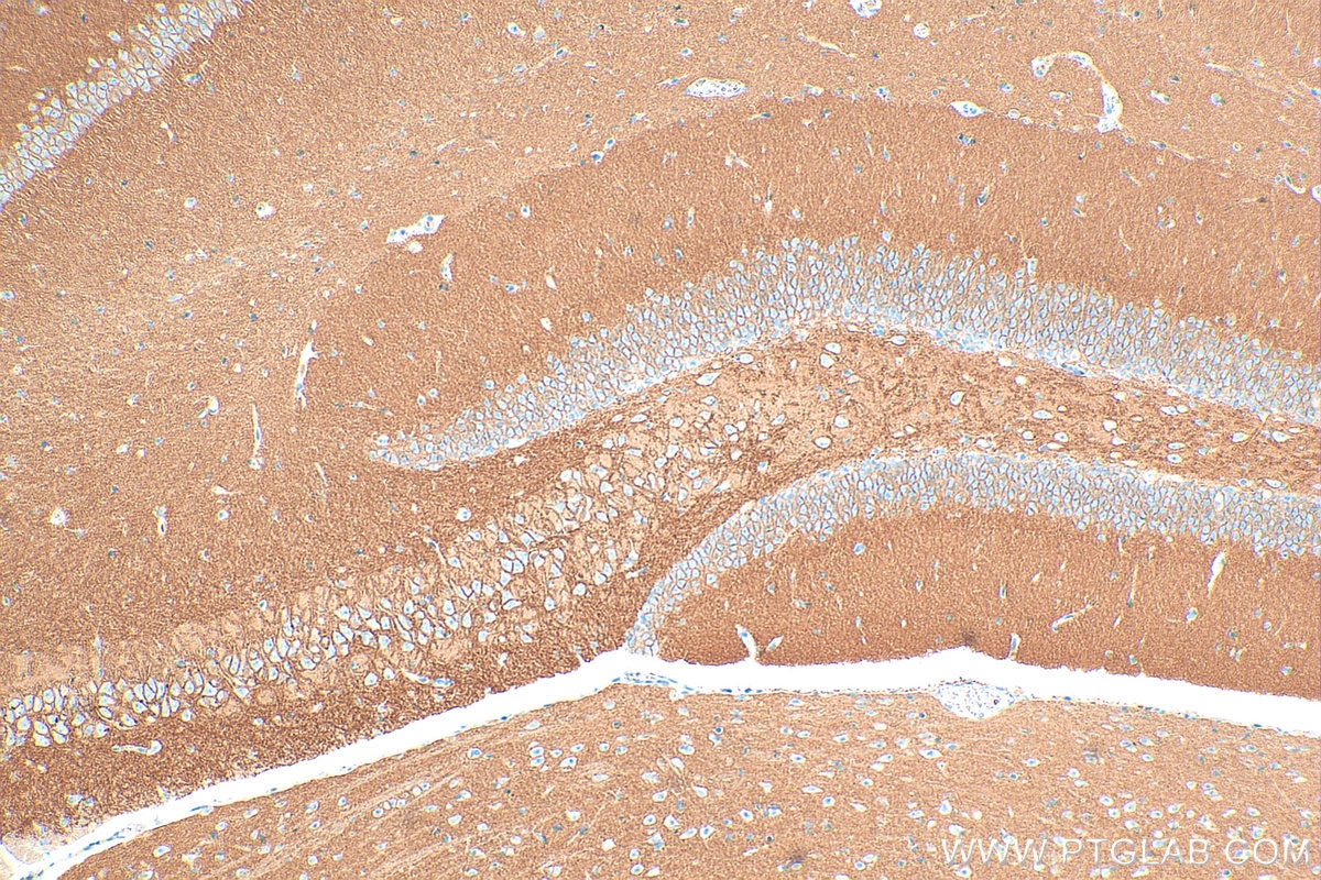 Immunohistochemistry (IHC) staining of mouse brain tissue using ATP2B3/PMCA3 Polyclonal antibody (31692-1-AP)