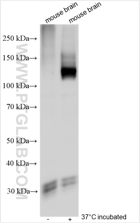 Western Blot (WB) analysis of various lysates using ATP2B3/PMCA3 Polyclonal antibody (31692-1-AP)