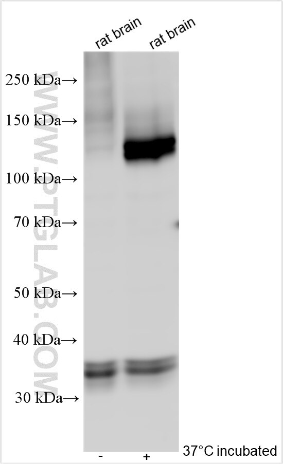 Western Blot (WB) analysis of various lysates using ATP2B3/PMCA3 Polyclonal antibody (31692-1-AP)