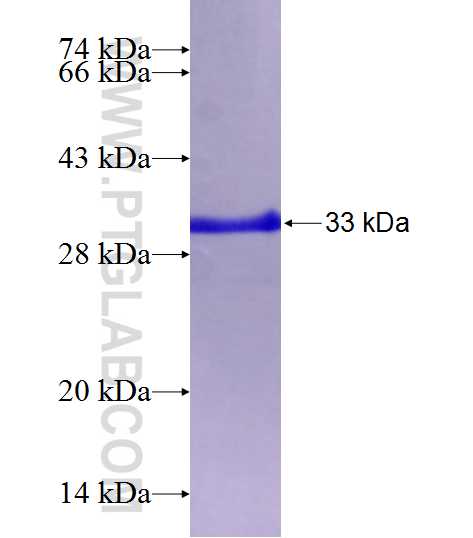 ATP2B4 fusion protein Ag22843 SDS-PAGE