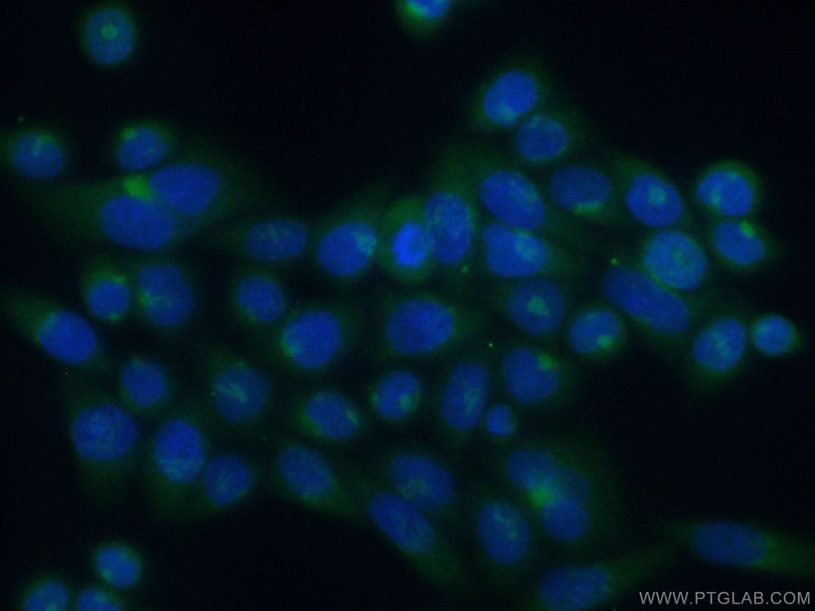 Immunofluorescence (IF) / fluorescent staining of HeLa cells using ATP2C1 Polyclonal antibody (13310-1-AP)