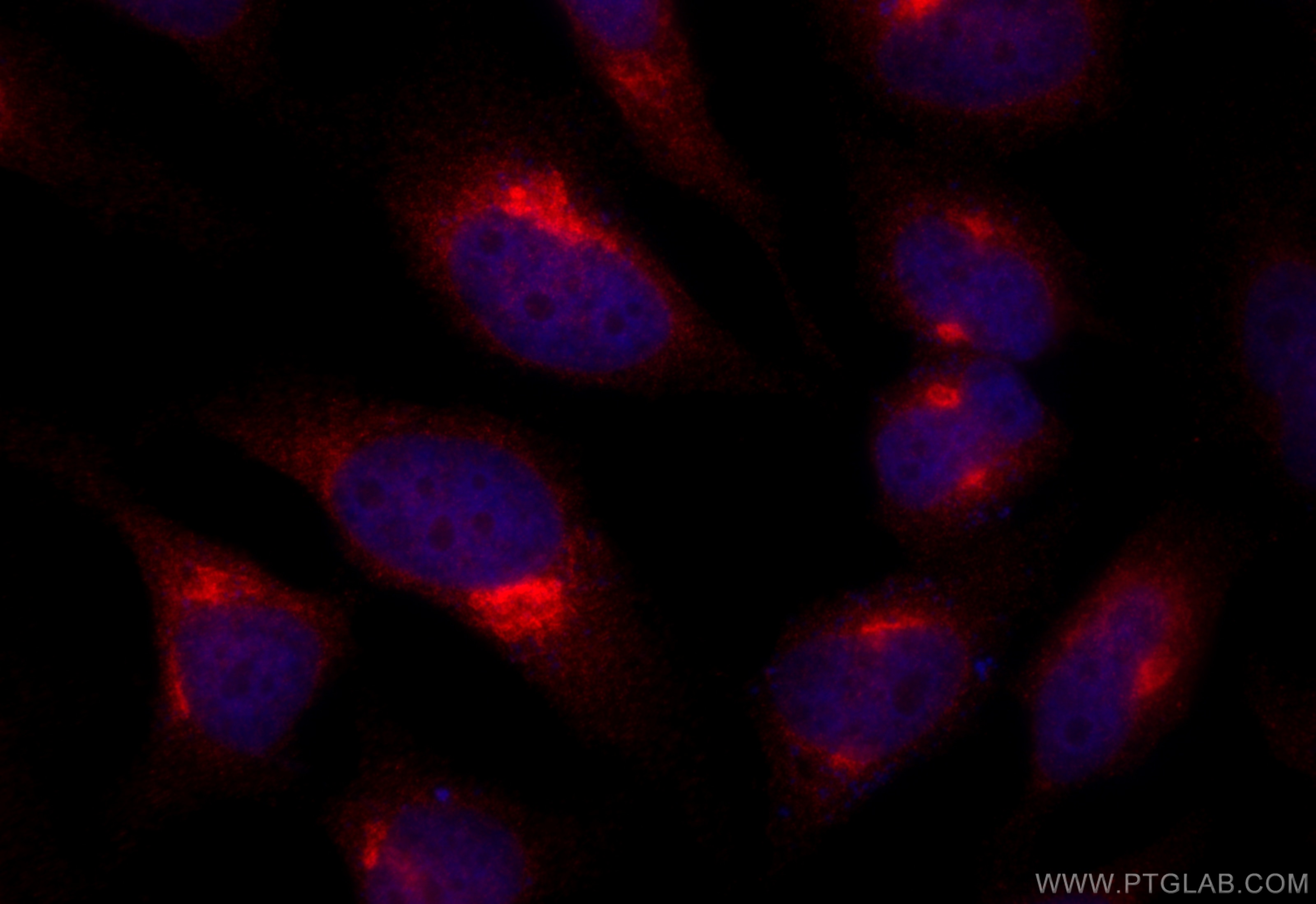 Immunofluorescence (IF) / fluorescent staining of HeLa cells using ATP2C1 Polyclonal antibody (13310-1-AP)