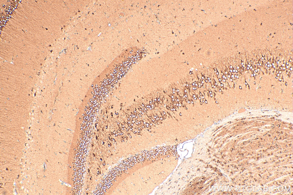 Immunohistochemistry (IHC) staining of mouse brain tissue using ATP2C1 Polyclonal antibody (13310-1-AP)