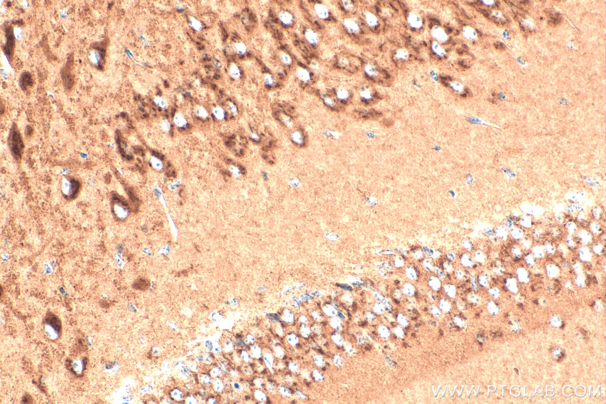 Immunohistochemistry (IHC) staining of mouse brain tissue using ATP2C1 Polyclonal antibody (13310-1-AP)