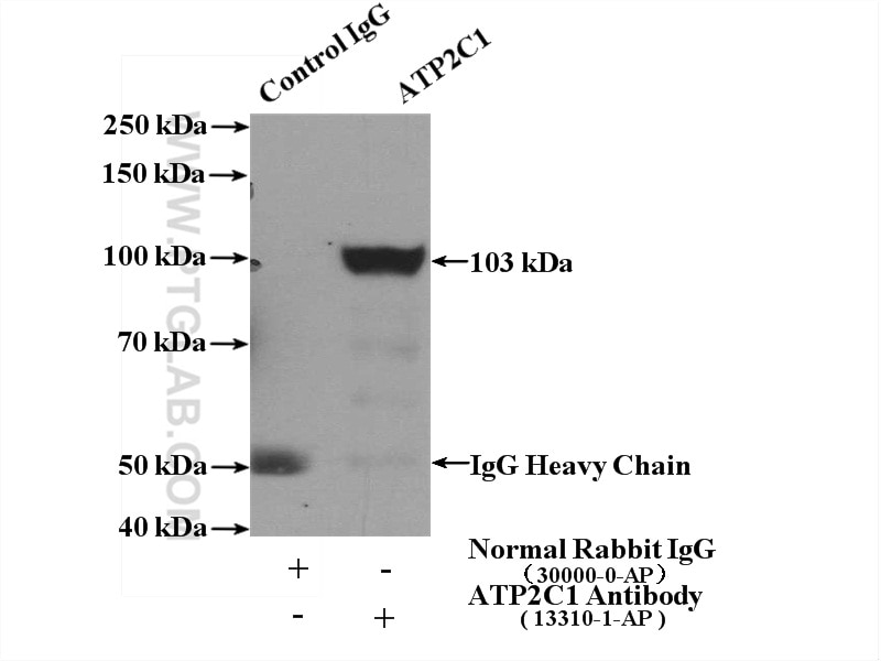 Immunoprecipitation (IP) experiment of mouse kidney tissue using ATP2C1 Polyclonal antibody (13310-1-AP)