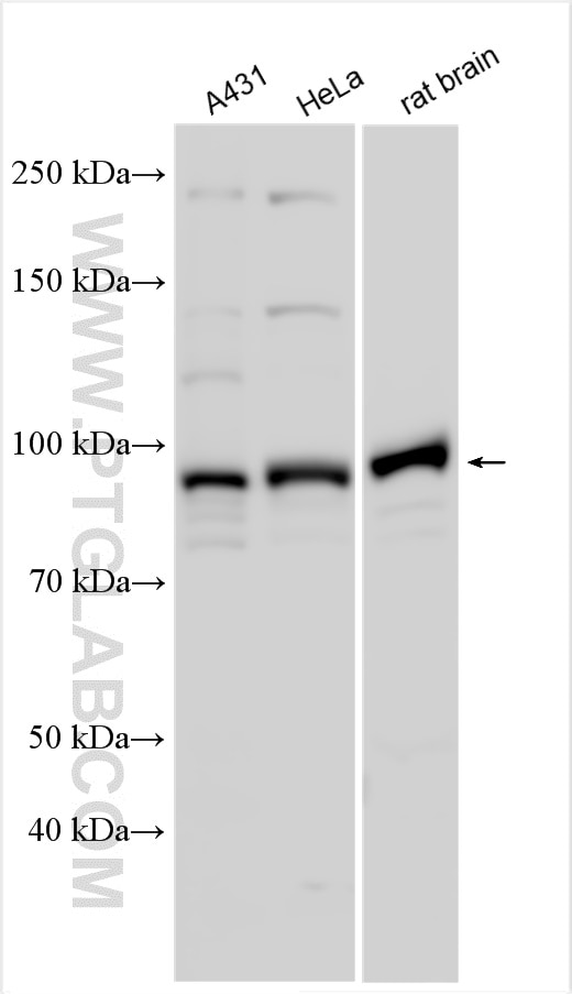 Western Blot (WB) analysis of various lysates using ATP2C1 Polyclonal antibody (13310-1-AP)