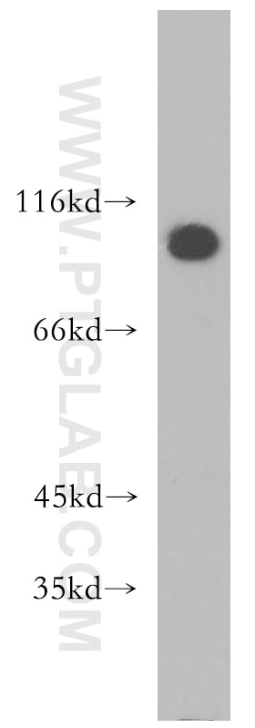 Western Blot (WB) analysis of HeLa cells using ATP2C1 Polyclonal antibody (13310-1-AP)