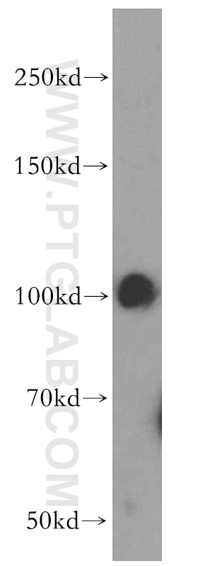 Western Blot (WB) analysis of human brain tissue using ATP2C1 Polyclonal antibody (13310-1-AP)