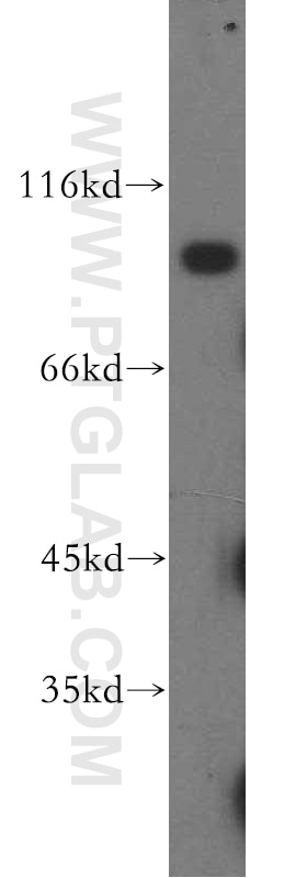 Western Blot (WB) analysis of A431 cells using ATP2C1 Polyclonal antibody (13310-1-AP)