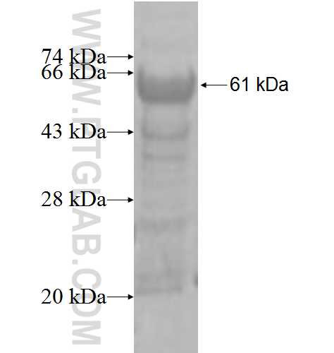 ATP2C1 fusion protein Ag4143 SDS-PAGE
