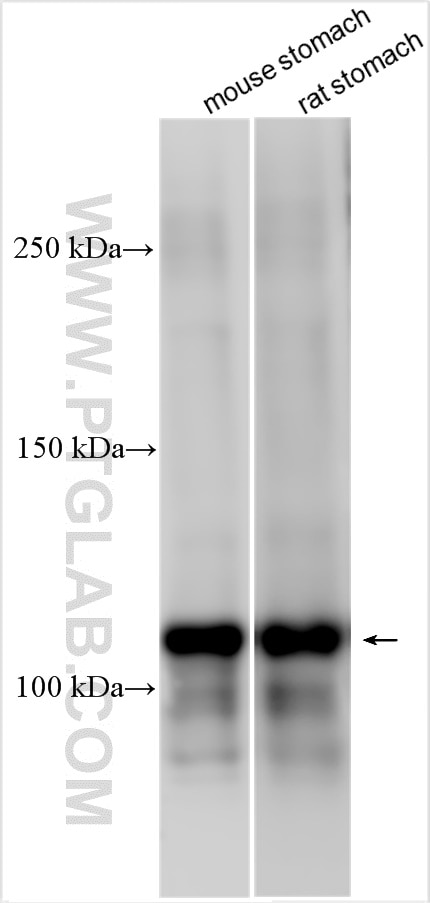 WB analysis using 55124-1-AP (same clone as 55124-1-PBS) Western Blot (WB) analysis of various lysates using ATP4A Polyclonal antibody (55124-1-AP)