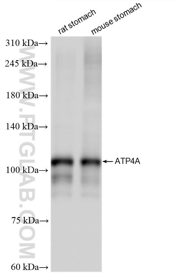 Western Blot (WB) analysis of various lysates using ATP4A Recombinant antibody (83079-5-RR)
