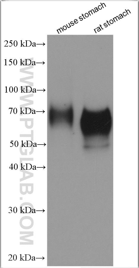 Western Blot (WB) analysis of various lysates using ATP4B Polyclonal antibody (18692-1-AP)