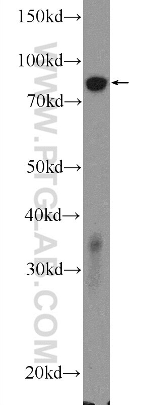 Western Blot (WB) analysis of rat kidney tissue using ATP4B Polyclonal antibody (18692-1-AP)