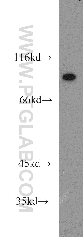 Western Blot (WB) analysis of mouse colon tissue using ATP4B Polyclonal antibody (18692-1-AP)