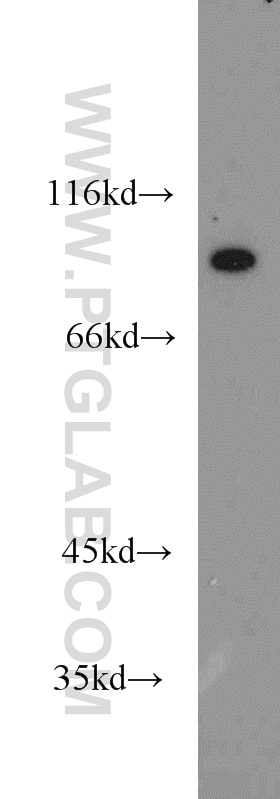 WB analysis of mouse colon using 18692-1-AP