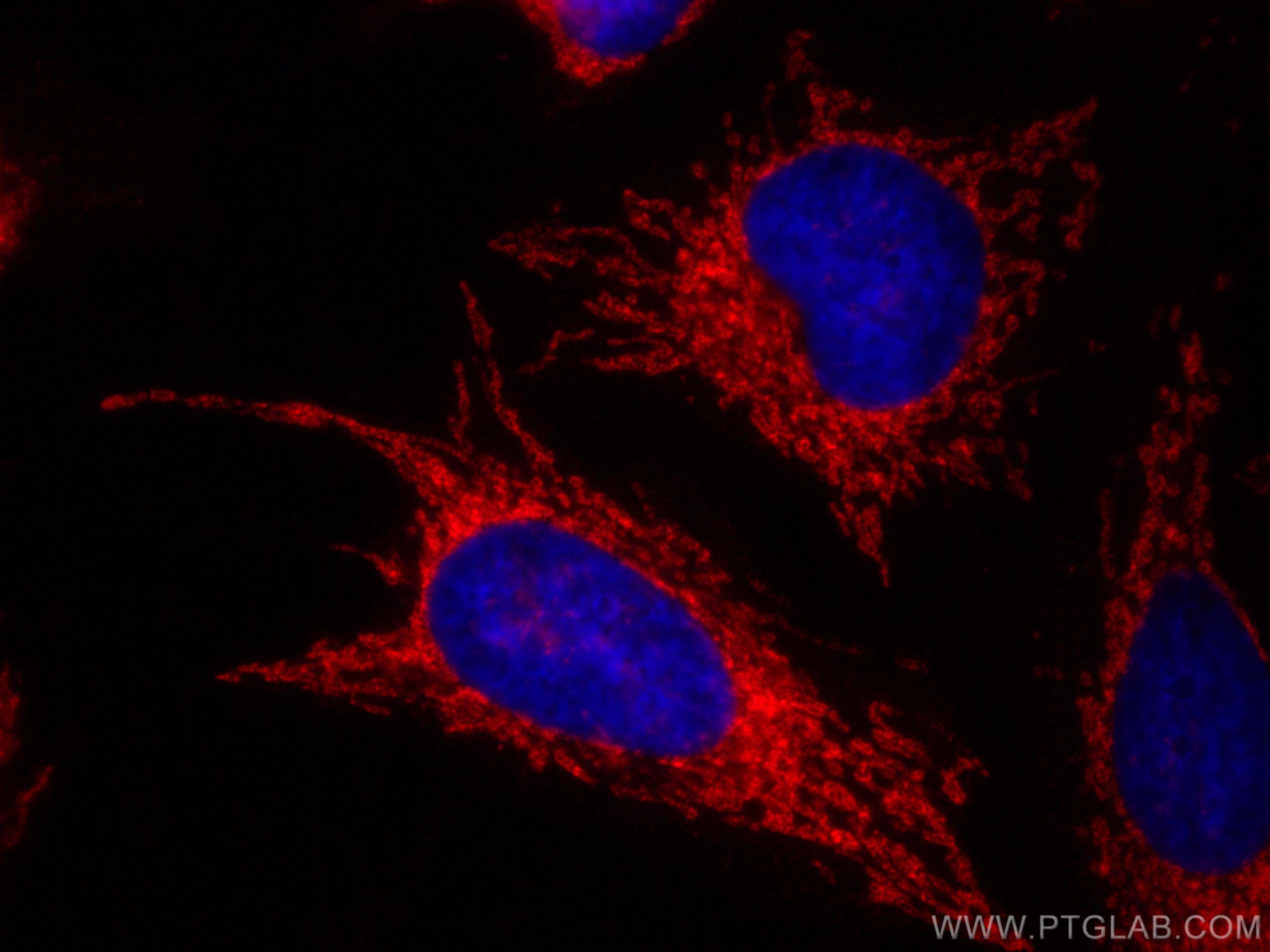 Immunofluorescence (IF) / fluorescent staining of HeLa cells using ATP5A1 Polyclonal antibody (14676-1-AP)