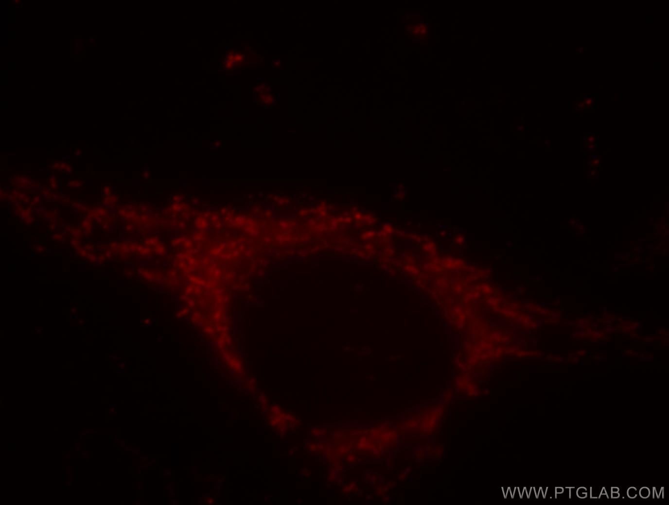 ATP5A1 Polyclonal antibody