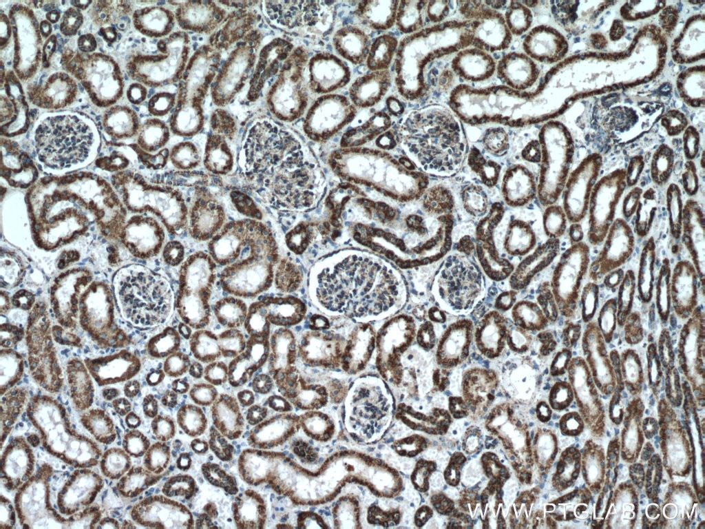 Immunohistochemistry (IHC) staining of human kidney tissue using ATP5A1 Polyclonal antibody (14676-1-AP)