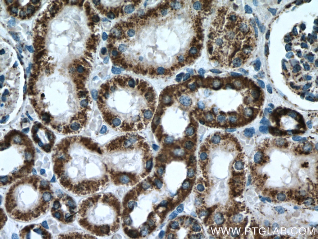 Immunohistochemistry (IHC) staining of human kidney tissue using ATP5A1 Polyclonal antibody (14676-1-AP)