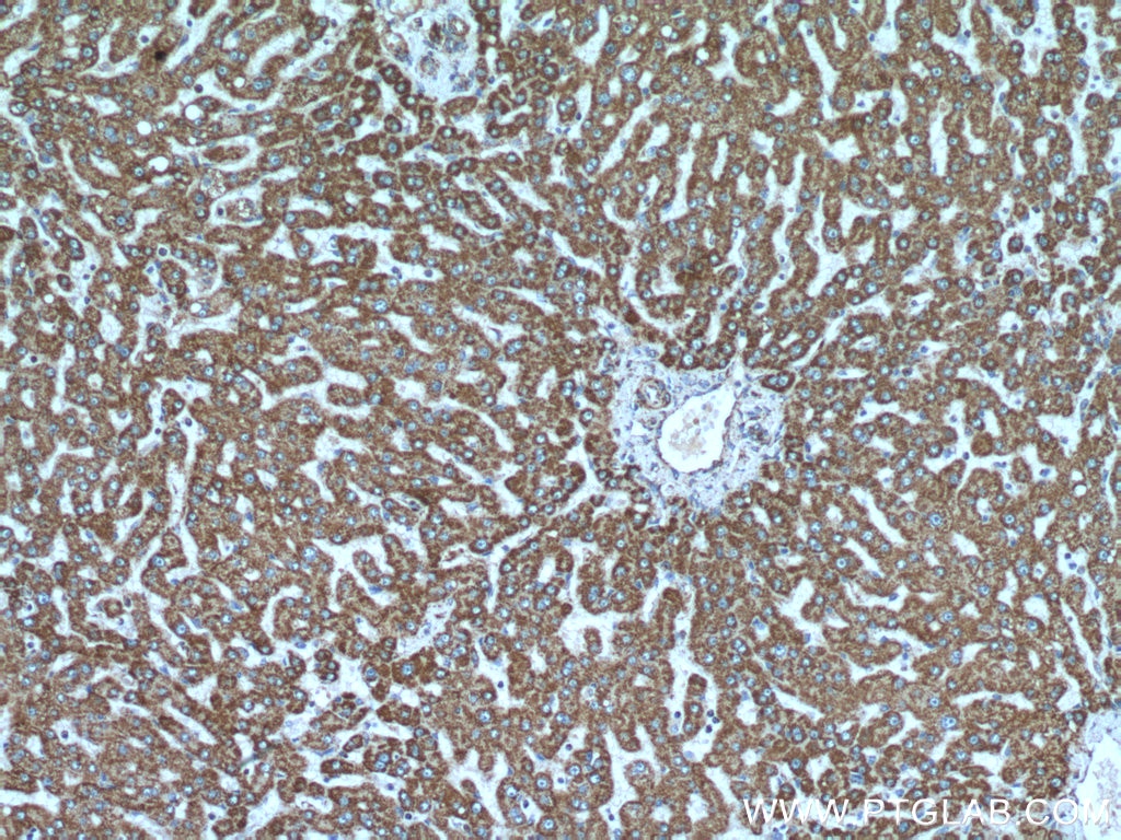 Immunohistochemistry (IHC) staining of human liver tissue using ATP5A1 Polyclonal antibody (14676-1-AP)