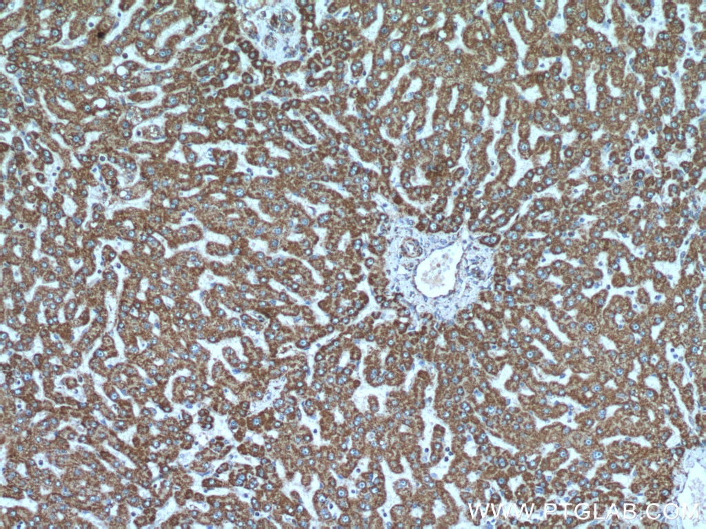 IHC staining of human liver using 14676-1-AP