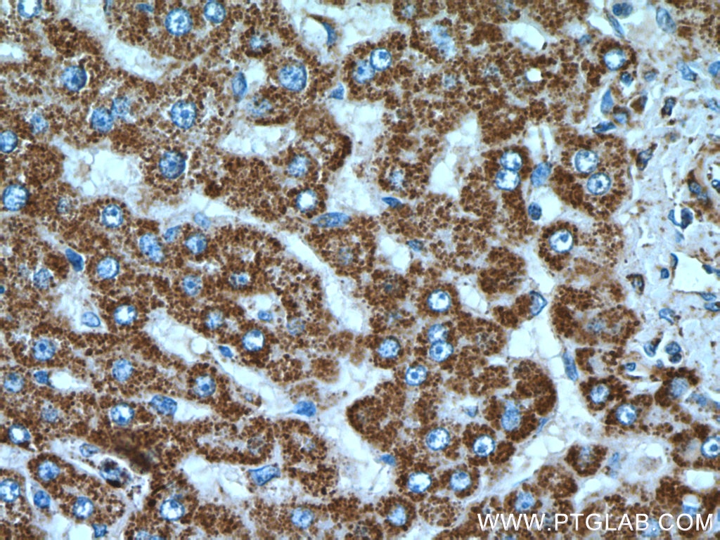 Immunohistochemistry (IHC) staining of human liver tissue using ATP5A1 Polyclonal antibody (14676-1-AP)