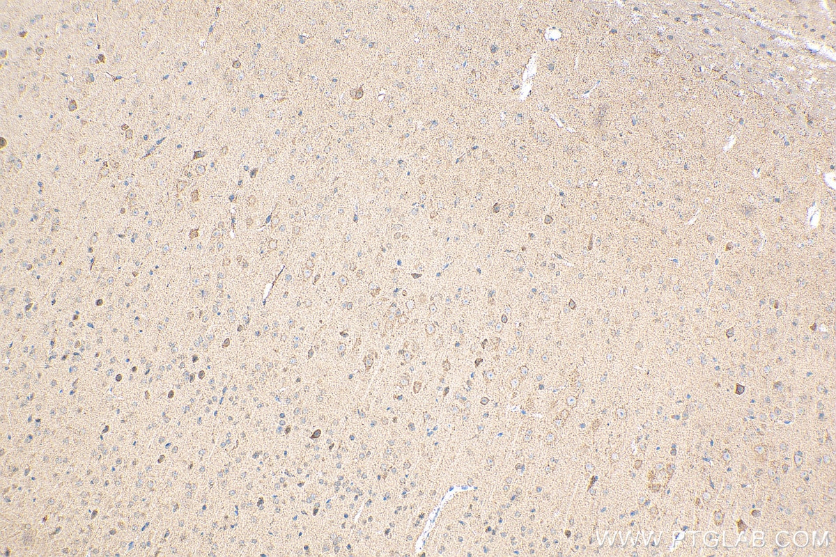Immunohistochemistry (IHC) staining of mouse brain tissue using ATP5A1 Polyclonal antibody (14676-1-AP)