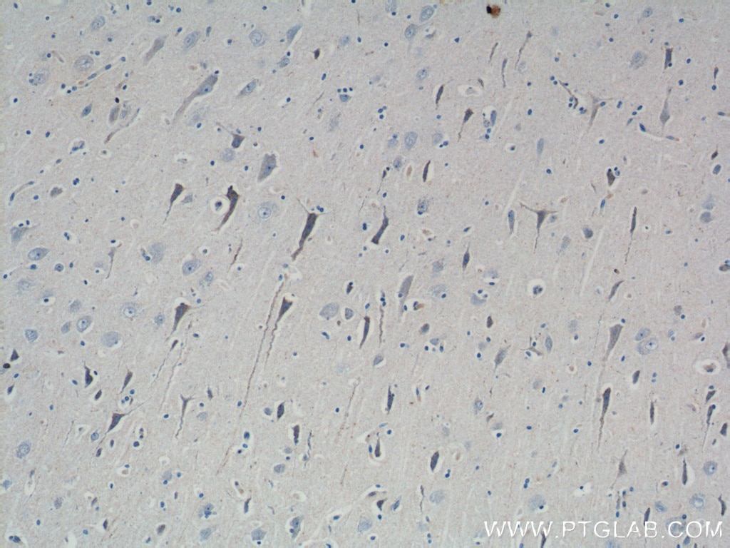 Immunohistochemistry (IHC) staining of human brain tissue using ATP5A1 Polyclonal antibody (14676-1-AP)