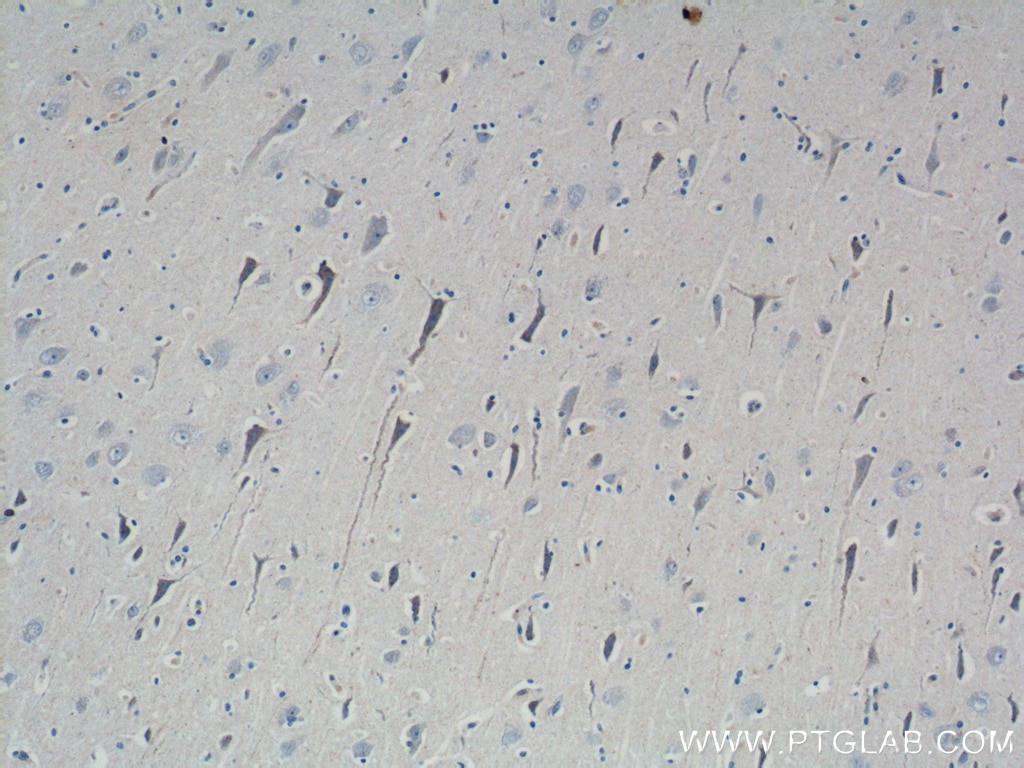 IHC staining of human brain using 14676-1-AP