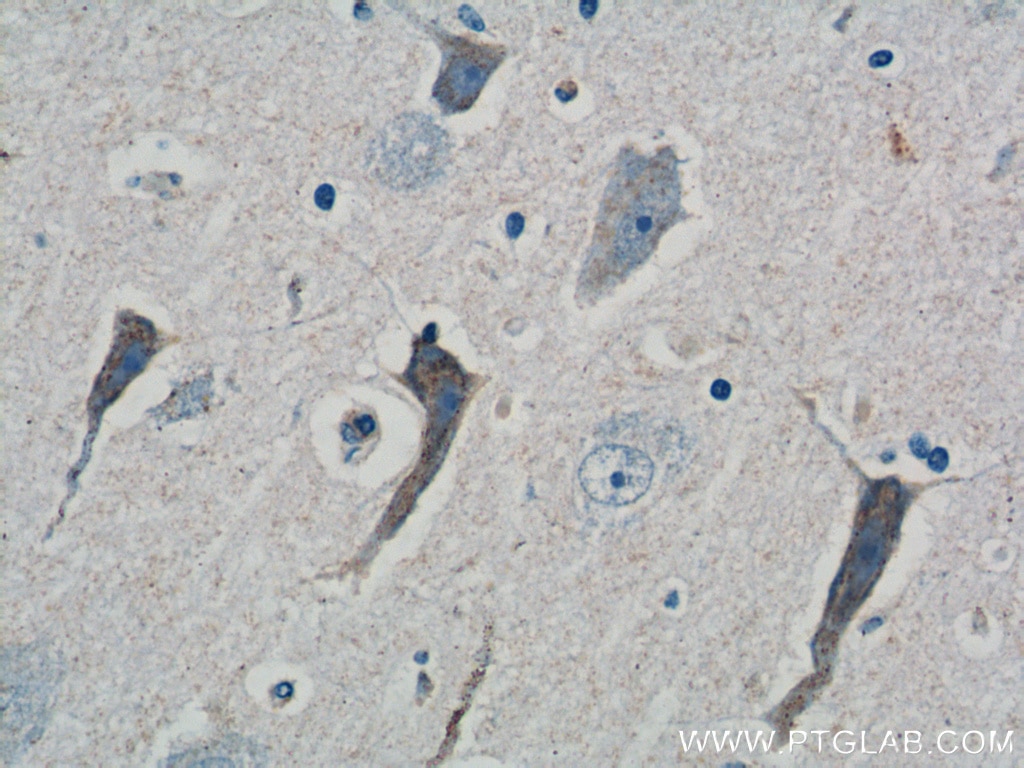 Immunohistochemistry (IHC) staining of human brain tissue using ATP5A1 Polyclonal antibody (14676-1-AP)