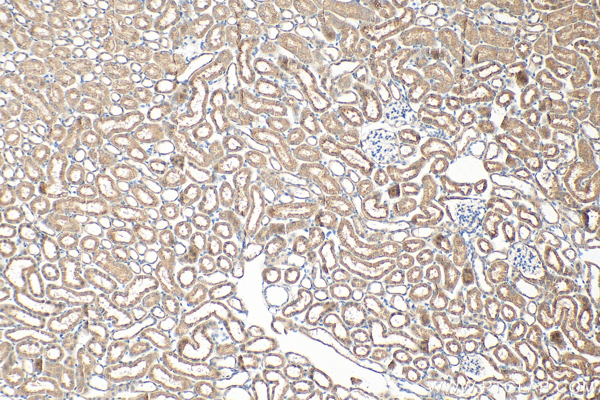 Immunohistochemistry (IHC) staining of mouse kidney tissue using ATP5A1 Polyclonal antibody (14676-1-AP)